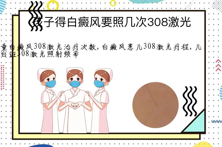 孩子得白癜风要照几次308激光