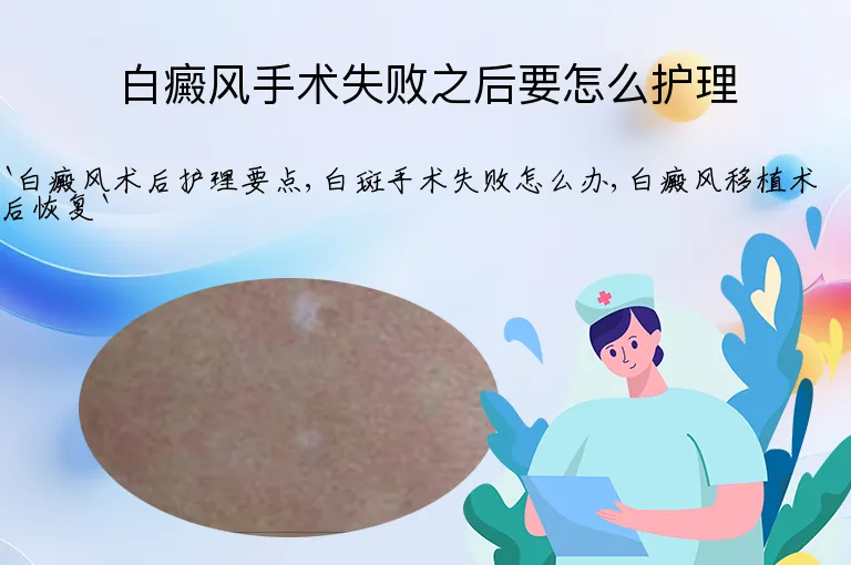 白癜风手术失败之后要怎么护理