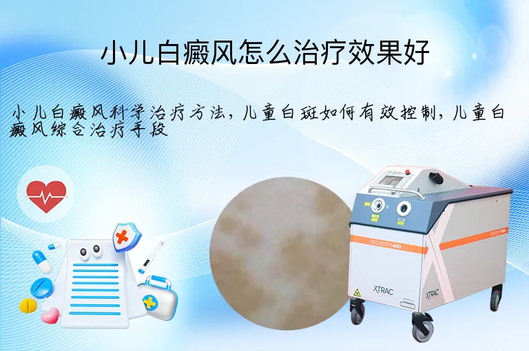 小儿白癜风怎么治疗效果好
