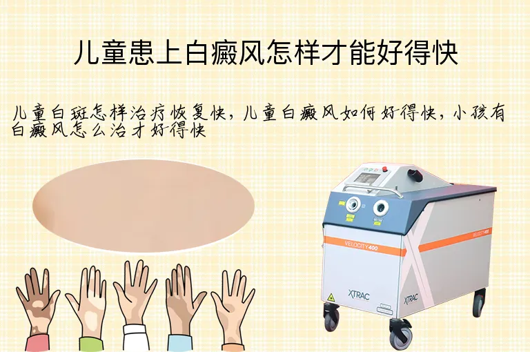 儿童患上白癜风怎样才能好得快