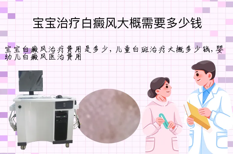 宝宝治疗白癜风大概需要多少钱