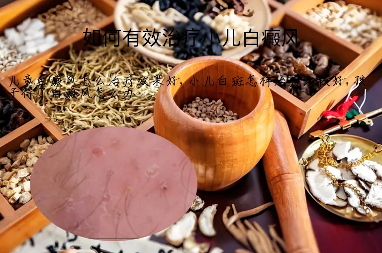 如何有效治疗小儿白癜风