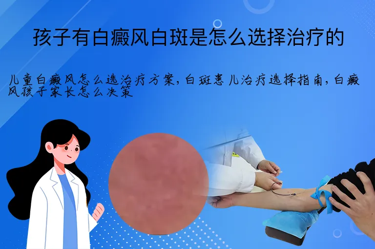 孩子有白癜风白斑是怎么选择治疗的