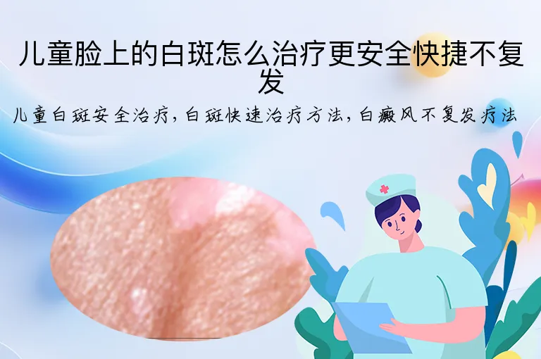 儿童脸上的白斑怎么治疗更安全快捷不复发