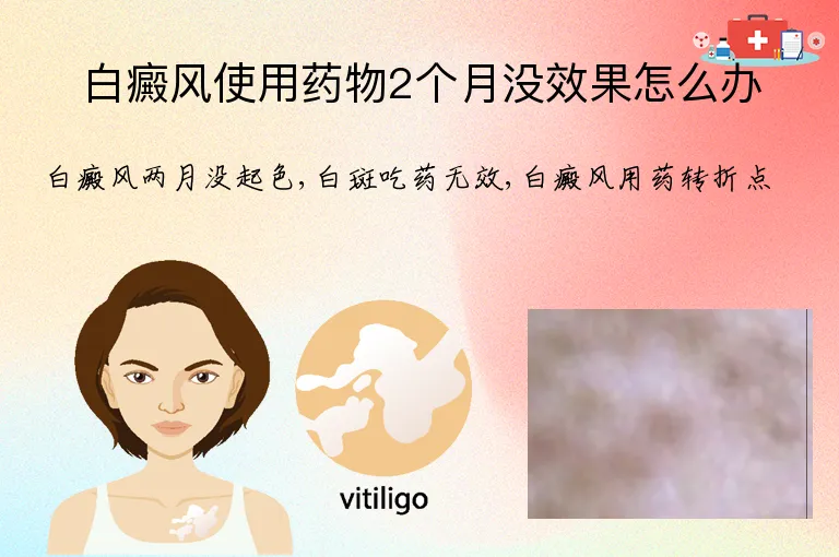 白癜风使用药物2个月没效果怎么办