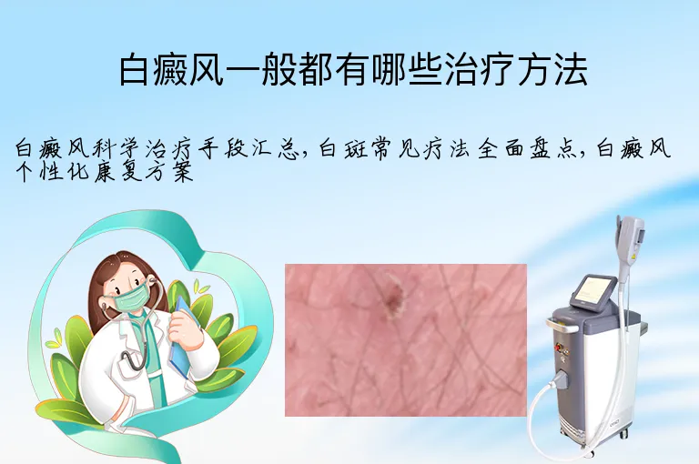 白癜风一般都有哪些治疗方法