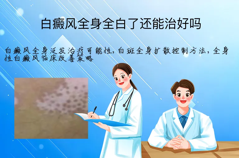 白癜风全身全白了还能治好吗