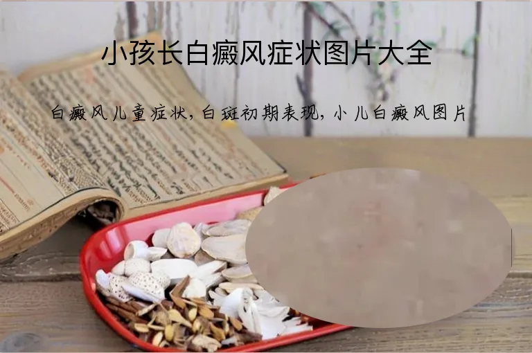 小孩长白癜风症状图片大全