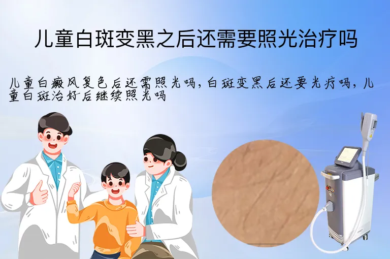 儿童白斑变黑之后还需要照光治疗吗