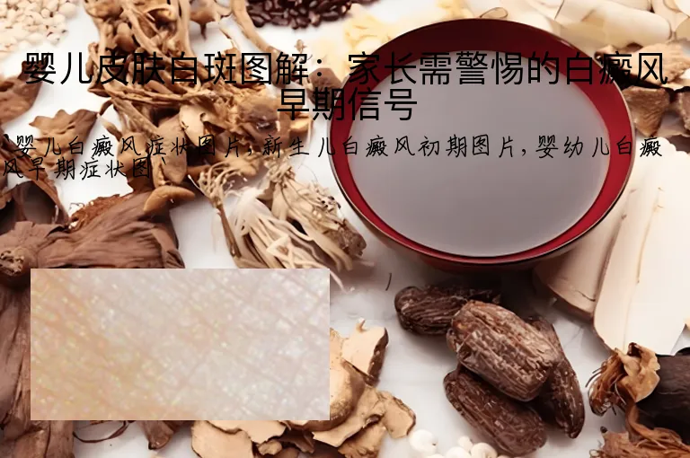 婴儿皮肤白斑图解：家长需警惕的白癜风早期信号