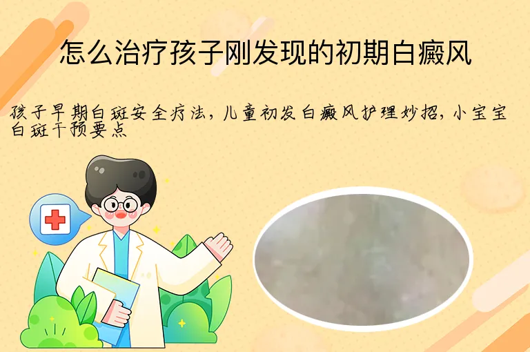 怎么治疗孩子刚发现的初期白癜风