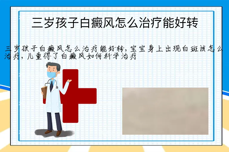 三岁孩子白癜风怎么治疗能好转