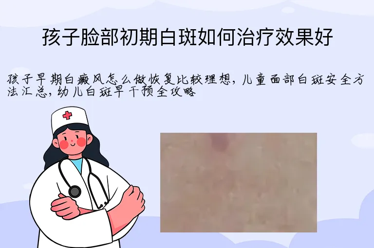 孩子脸部初期白斑如何治疗效果好