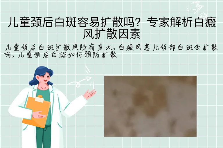 儿童颈后白斑容易扩散吗?专家解析白癜风扩散因素