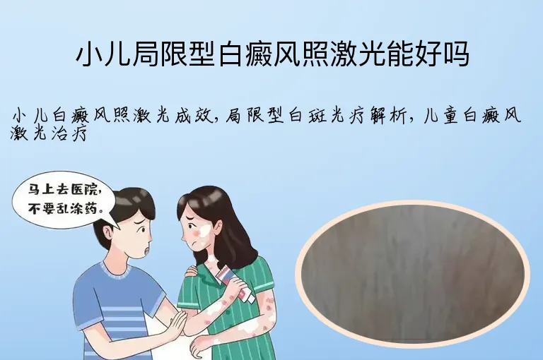 小儿局限型白癜风照激光能好吗
