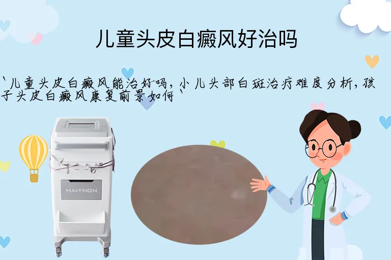 儿童头皮白癜风好治吗