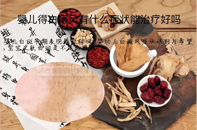 婴儿得白癜风有什么症状能治疗好吗