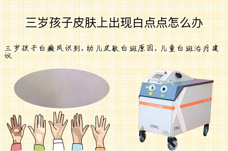 三岁孩子皮肤上出现白点点怎么办