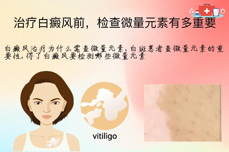 治疗白癜风前，检查微量元素有多重要