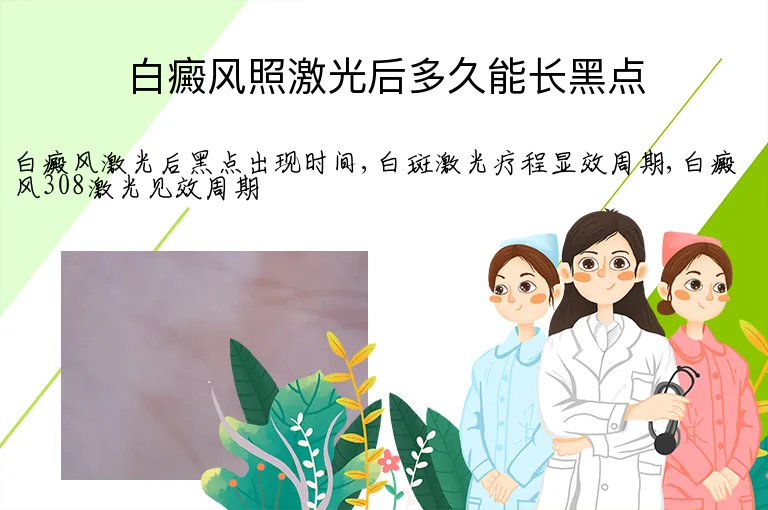 白癜风照激光后多久能长黑点