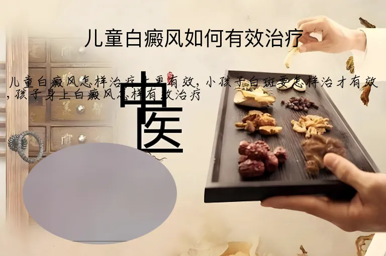 儿童白癜风如何有效治疗