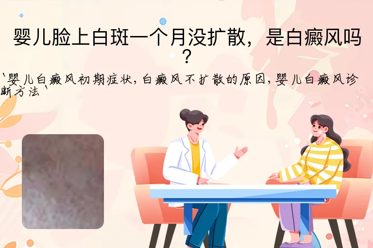 婴儿脸上白斑一个月没扩散，是白癜风吗？