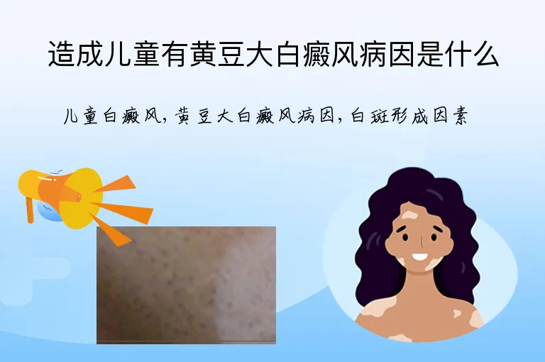 造成儿童有黄豆大白癜风病因是什么