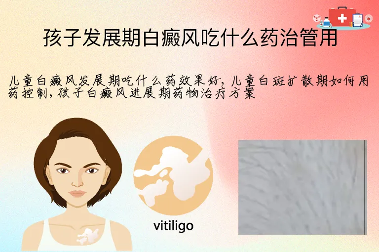 孩子发展期白癜风吃什么药治管用