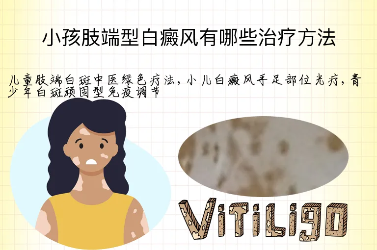小孩肢端型白癜风有哪些治疗方法