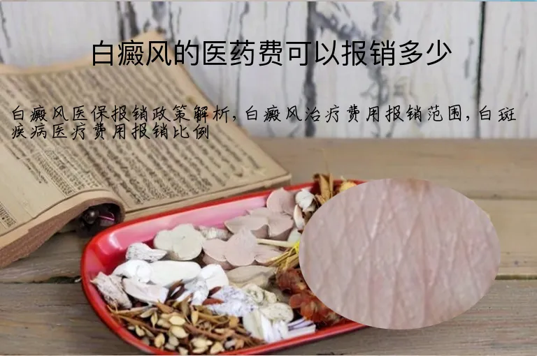 白癜风的医药费可以报销多少