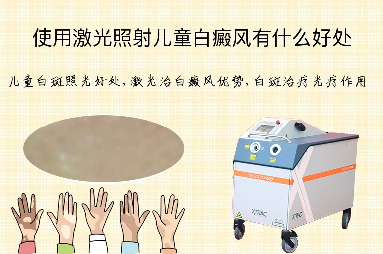 使用激光照射儿童白癜风有什么好处