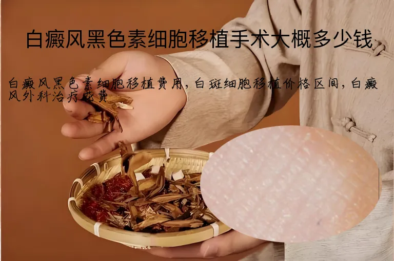 白癜风黑色素细胞移植手术大概多少钱