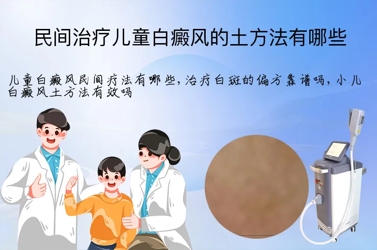 民间治疗儿童白癜风的土方法有哪些