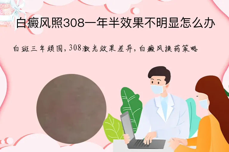 白癜风照308一年半效果不明显怎么办