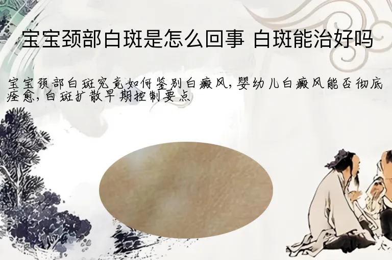 宝宝颈部白斑是怎么回事 白斑能治好吗