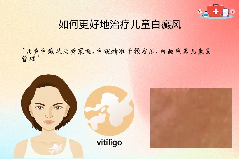 如何更好地治疗儿童白癜风
