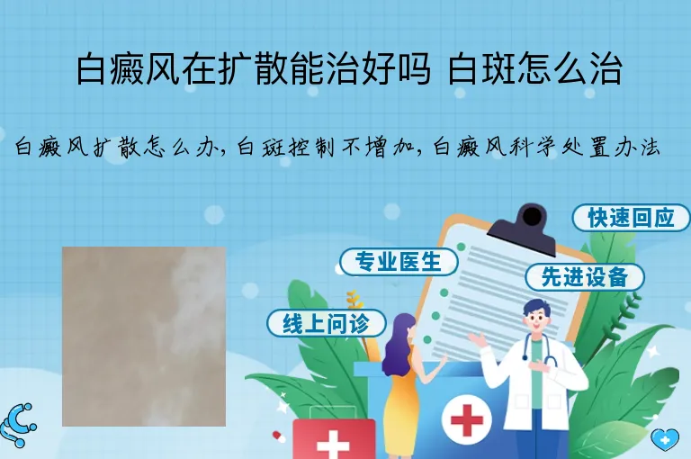 白癜风在扩散能治好吗 白斑怎么治