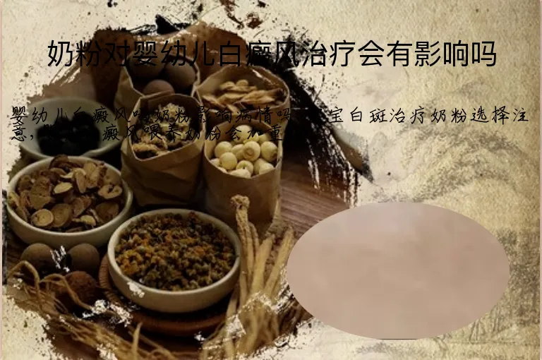 奶粉对婴幼儿白癜风治疗会有影响吗