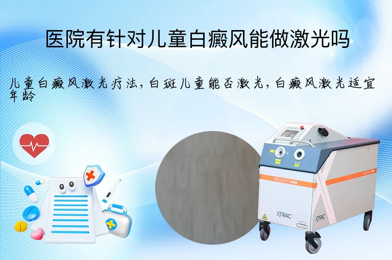 医院有针对儿童白癜风能做激光吗