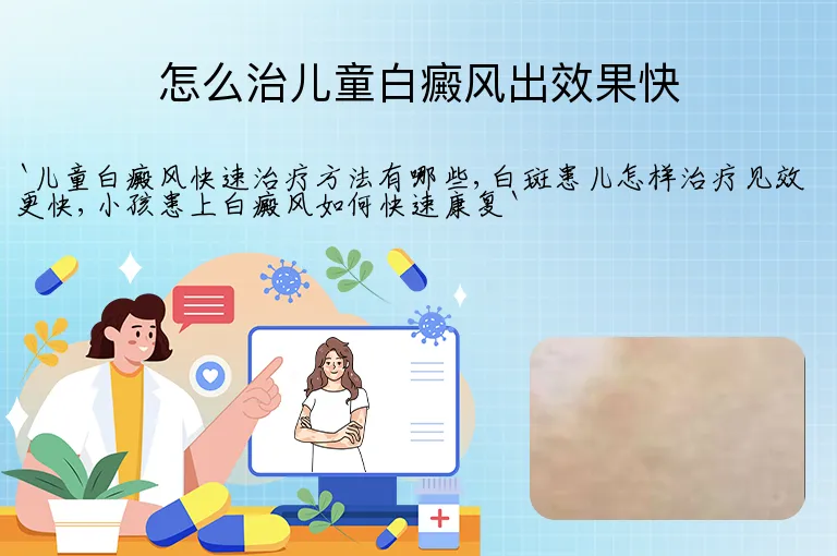 怎么治儿童白癜风出效果快