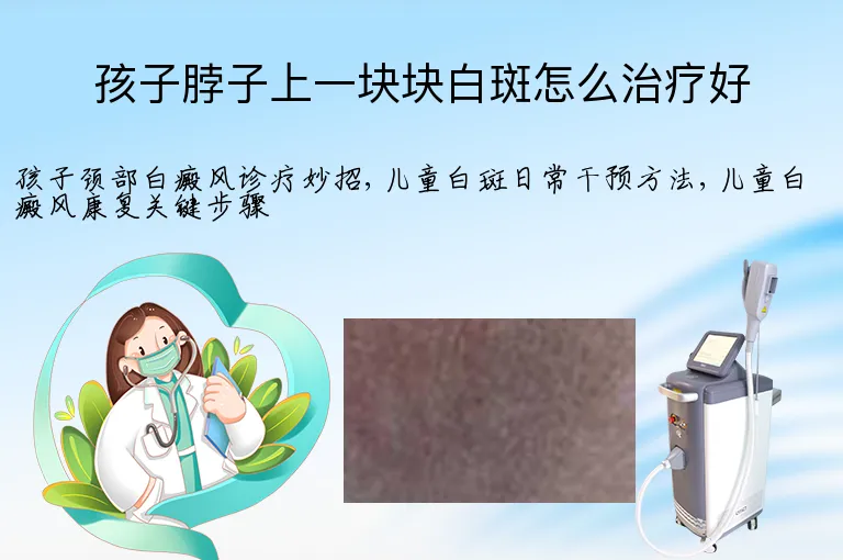 孩子脖子上一块块白斑怎么治疗好