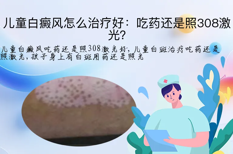 儿童白癜风怎么治疗好：吃药还是照308激光？