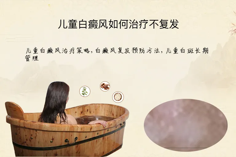 儿童白癜风如何治疗不复发