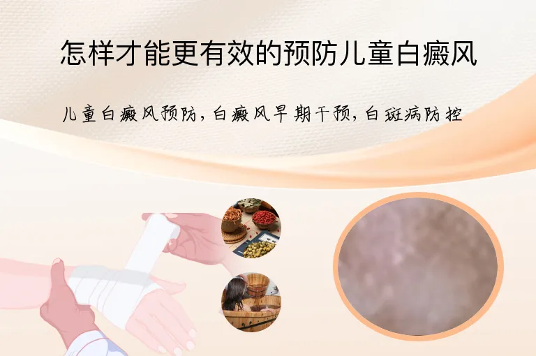 怎样才能更有效的预防儿童白癜风