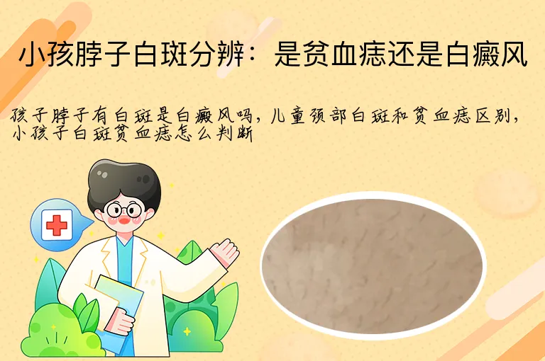 小孩脖子白斑分辨:是贫血痣还是白癜风