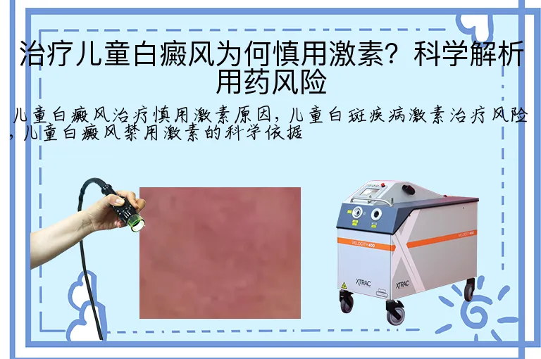 治疗儿童白癜风为何慎用激素？科学解析用药风险