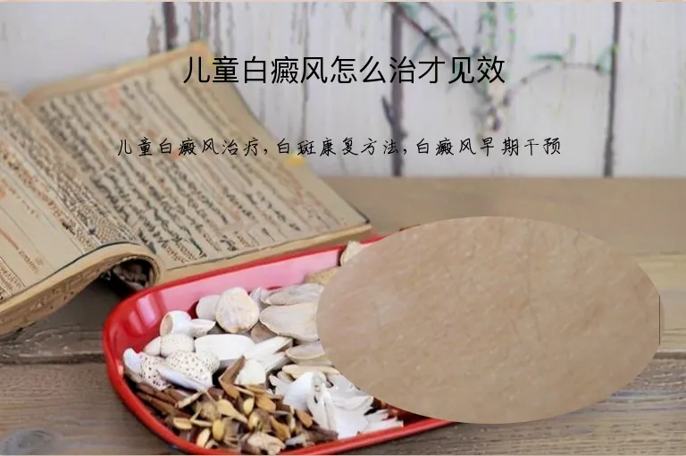 儿童白癜风怎么治才见效