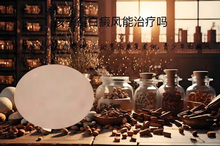 孩子得白癜风能治疗吗