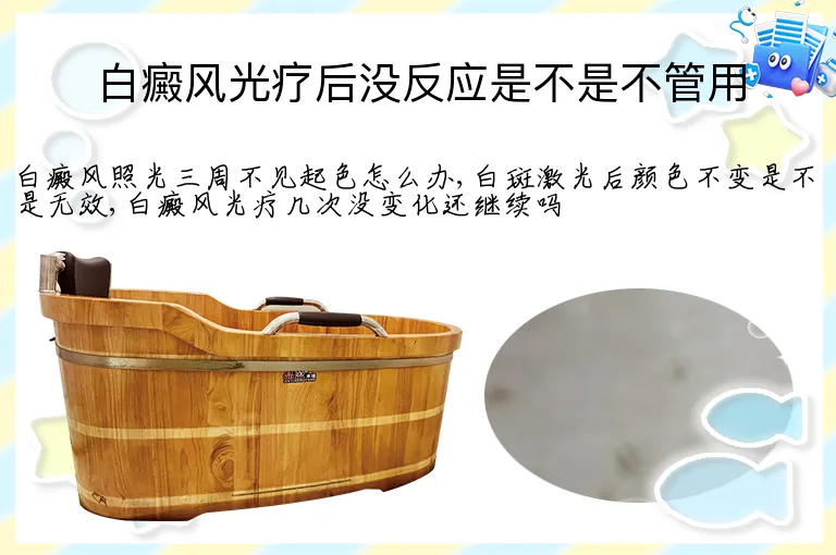 白癜风光疗后没反应是不是不管用