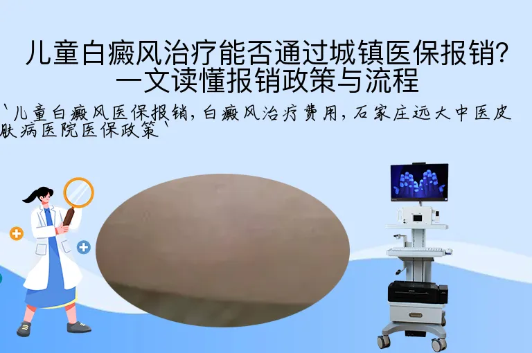 儿童白癜风治疗能否通过城镇医保报销？一文读懂报销政策与流程